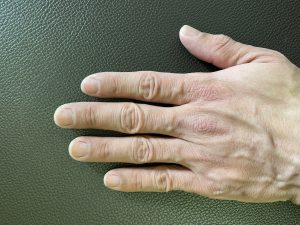 手の指の長さを比較する写真