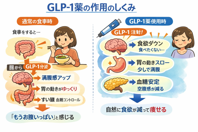 GLP1をわかりやすく絵にしている